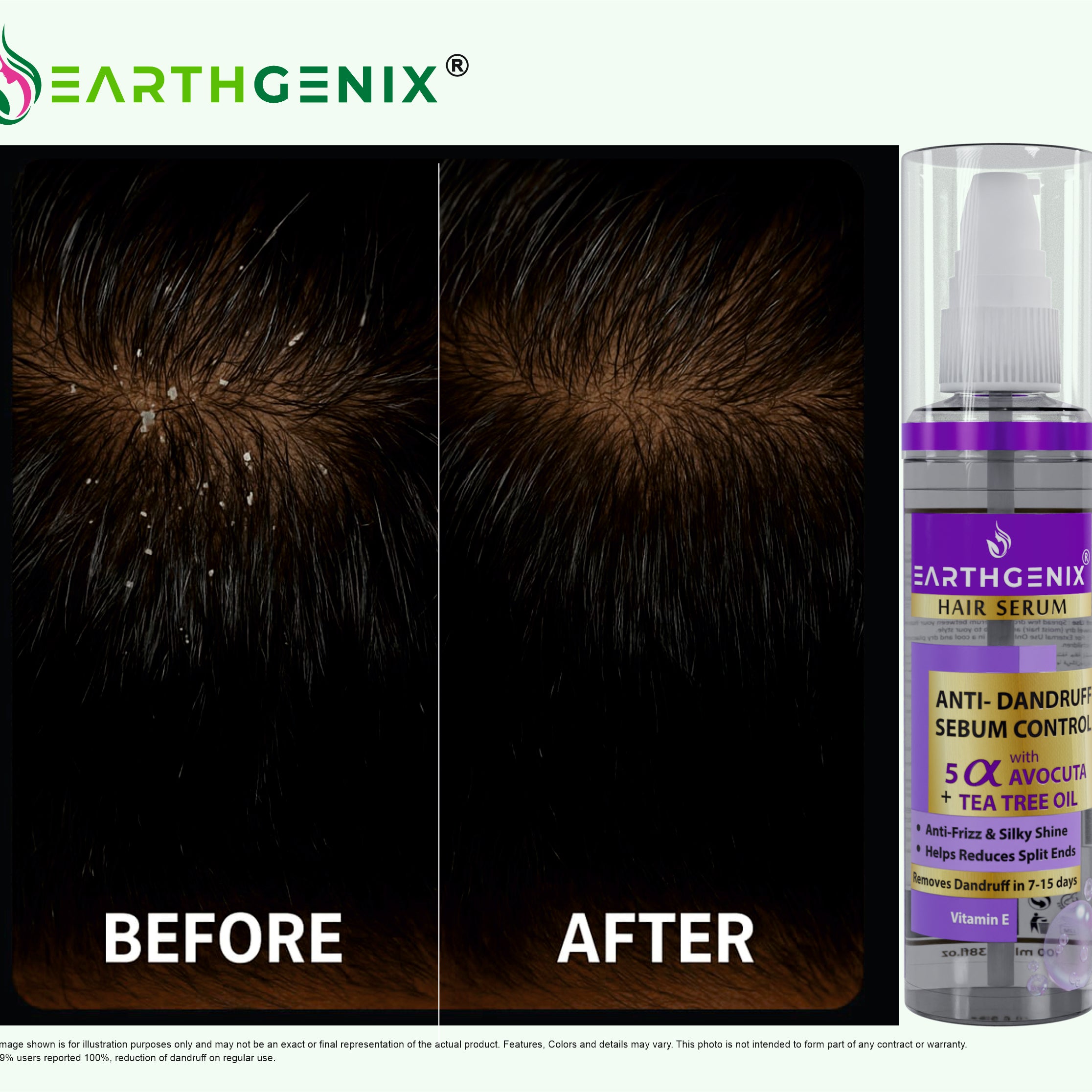 Anti-Dandruff & Sebum Control Hair Serum with 5 Alpha Avocuta & Tea Tree Oil | with Vitamin- E | Removes Dandruff in 7-15 Days | for Men And Women