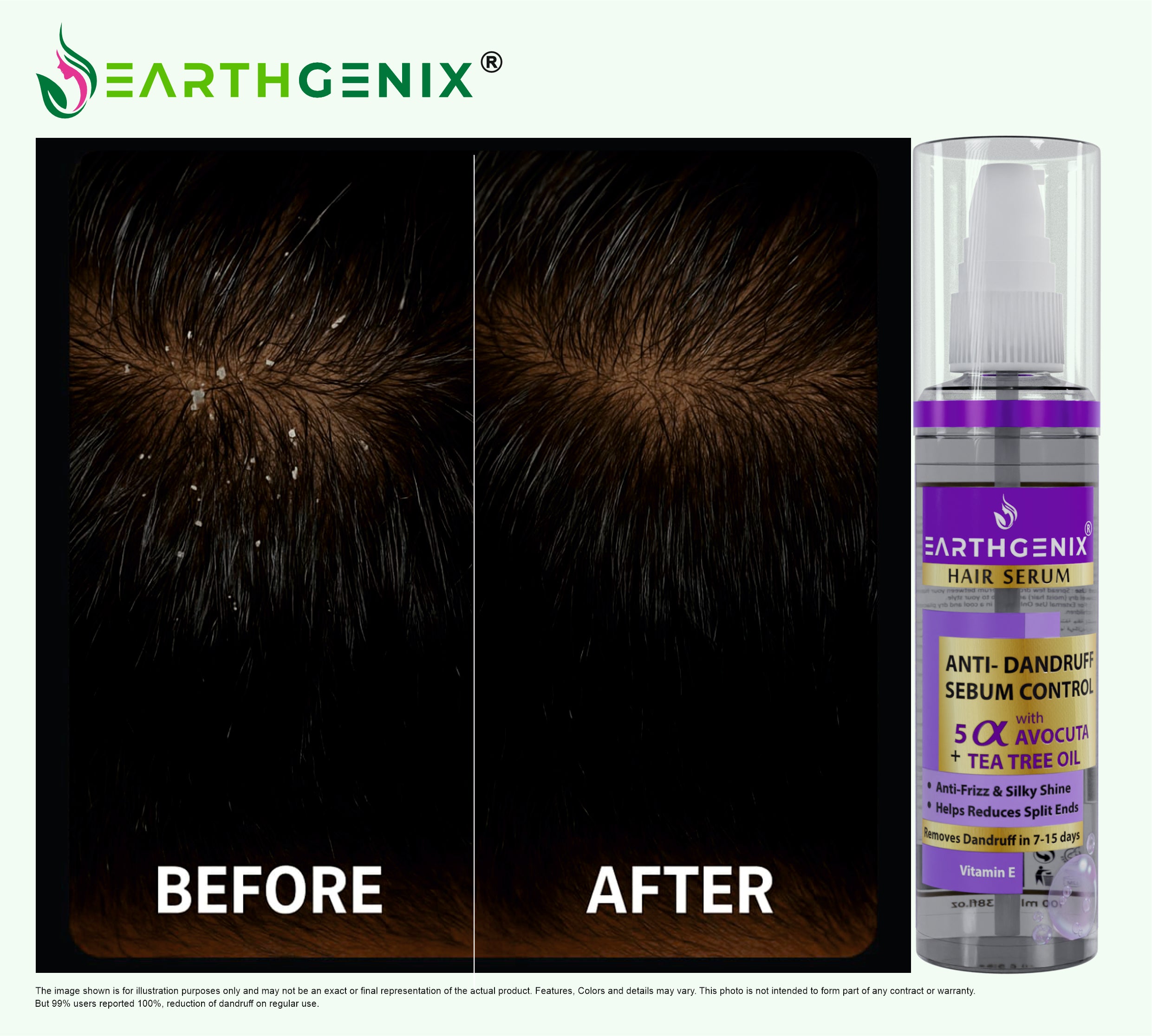 Anti-Dandruff & Sebum Control Hair Serum with 5 Alpha Avocuta & Tea Tree Oil | with Vitamin- E | Removes Dandruff in 7-15 Days | for Men And Women