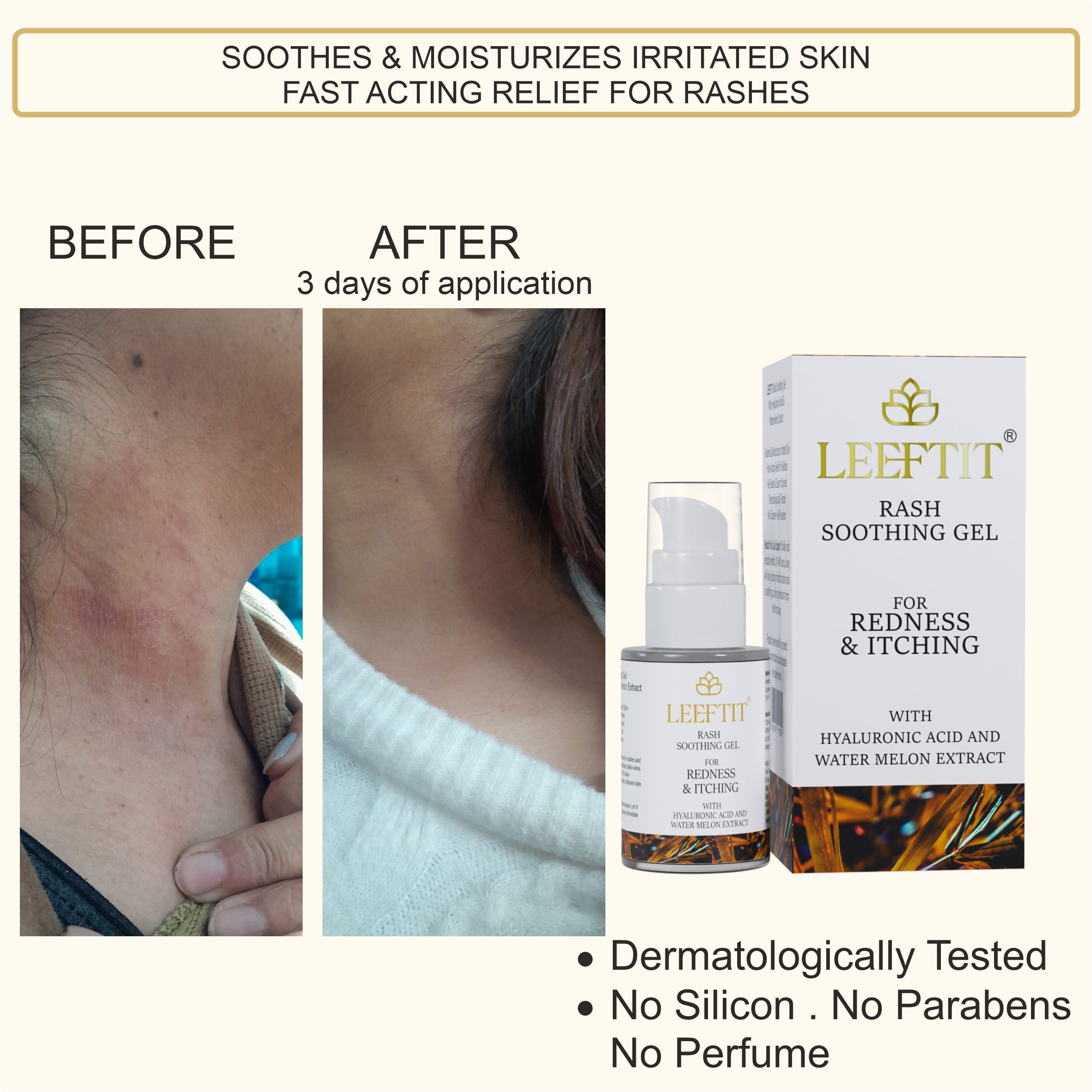 Leeftit Rash Soothing Gel for Redness & Itching